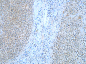 Immunohistochemistry staining of the Mad2L1 antigen in normal human tonsil using IQ239 antibody.  Tissues were formalin-fixed and paraffin-embedded. Antibody was used at 1/200 dilution for 1hour at room temperature  following antigen retrieval with Tris-EDTA pH9.