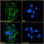 Immunofluorescence analysis of paraformaldehyde fixed Caco-2 cells,  permeabilized with 0.15% Triton. Primary incubation 1hr (1:100 dilution) followed by Alexa Fluor® 488 secondary antibody (1:1000 dilution), showing cell junction staining. The nuclear stain is DAPI (blue). Negative control: Mouse IgG1 negative control followed by Alexa Fluor® 488 secondary antibody.