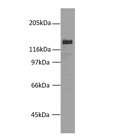 Western blot - Desmoglein 2/DSG2 antibody [7H9] on A431 cell lysate
