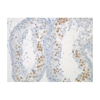 Immunohistochemistry staining of the Mad2L1 antigen in human testis using IQ239 antibody.  Tissues were formalin-fixed and paraffin-embedded. Antibody was used at 1/200 dilution for 1hour at room temperature  following antigen retrieval with Tris-EDTA pH9.
