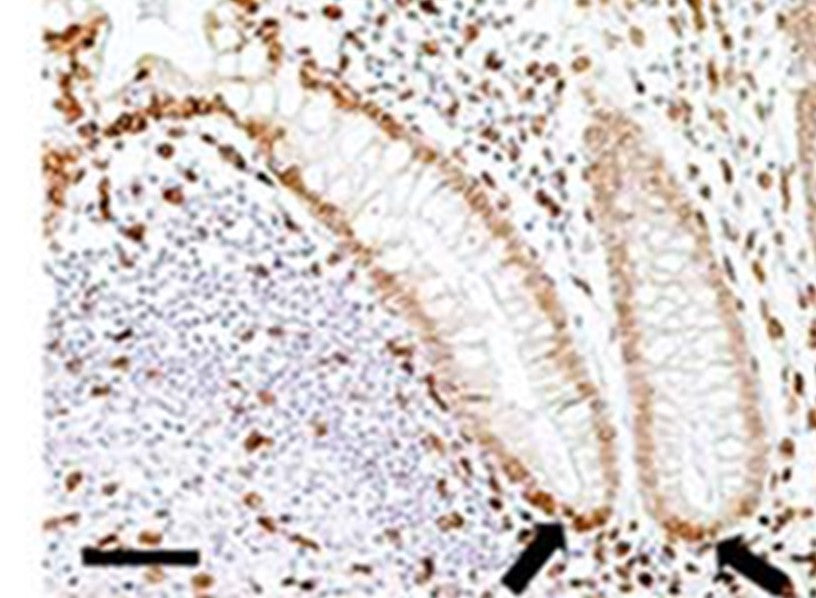 IHC using Lamin A/C antibody (IQ332) clone JOL2  on Human colon