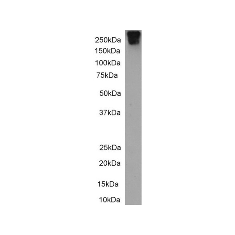 Western Blot of clone CBL 017 6856 anti-human CD109 (0.5µg/ml) with lysate of Human pancreas (35µg protein). Expected MW 162kD, observed broad band at 190-250kD due to PTM. Primary incubation was 1 hour. Detected by chemiluminescence.