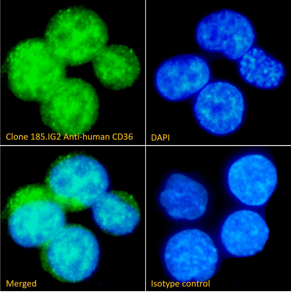 Immunofluorescence analysis of clone 185.IG2 anti-human
CD36 staining paraformaldehyde fixed U937 cells
immobilized on Shi-fix™ plus cover-slips. Primary incubation
1hr (1:100 dilution) followed by Alexa Fluor® 488 secondary
antibody (1:1000 dilution), showing nuclear and cytoplasmic
staining. The nuclear stain is DAPI (blue).
