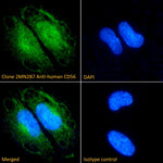 Immunofluorescence analysis of clone 2MN2B7 Anti-human CD56 staining paraformaldehyde fixed N2A cells. Primary incubation 1hr (1:100 dilution) followed by Alexa Fluor® 488 secondary antibody (1:1000 dilution), showing nuclear and cytoplasmic staining. The nuclear stain is DAPI (blue).