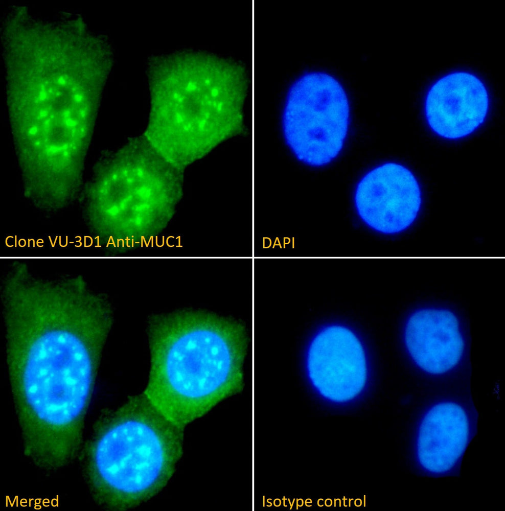 Immunofluorescence analysis of clone VU-3D1 Anti-MUC1 staining paraformaldehyde fixed MCF-7 cells. Primary incubation 1hr (1:100 dilution) followed by Alexa Fluor® 488
secondary antibody (1:1000 dilution), showing nuclear and cytoplasmic staining. The nuclear stain is DAPI (blue).