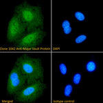 Immunofluorescence analysis of Clone 1032, Anti-Major Vault Protein antibody, staining paraformaldehyde fixed A549 cells. Primary antibody incubation 1hr (1:100 dilution) followed by Alexa Fluor® 488 secondary antibody (1:1000 dilution), showing mainly nuclear and some cytoplasmic staining. The nuclear stain is DAPI (blue).