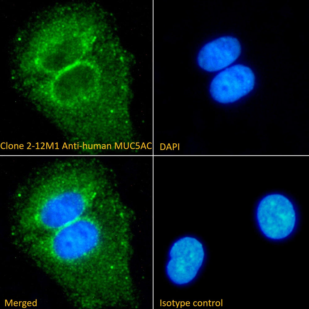 Immunofluorescence analysis of clone 2-12M1 anti-human MUC5AC staining paraformaldehyde fixed A549 cells. Primary incubation 1hr (1:100 dilution) followed by Alexa Fluor® 488 secondary antibody (1:1000 dilution), showing cytoplasmic staining. The nuclear stain is DAPI (blue).