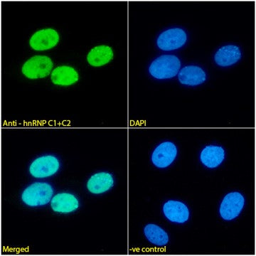 Immunofluorescence analysis of paraformaldehyde fixed MCF7 cells,  permeabilized with 0.15% Triton. Primary incubation 1hr (1:100 dilution) followed by Alexa Fluor® 488 secondary antibody (1:1000 dilution), showing nuclear staining. The nuclear stain is DAPI (blue). Negative control: Mouse IgG1 negative control followed by Alexa Fluor® 488 secondary antibody.