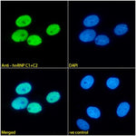 Immunofluorescence analysis of paraformaldehyde fixed MCF7 cells,  permeabilized with 0.15% Triton. Primary incubation 1hr (1:100 dilution) followed by Alexa Fluor® 488 secondary antibody (1:1000 dilution), showing nuclear staining. The nuclear stain is DAPI (blue). Negative control: Mouse IgG1 negative control followed by Alexa Fluor® 488 secondary antibody.