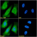 Immunofluorescence analysis of paraformaldehyde fixed HeLa cells,  permeabilized with 0.15% Triton. Primary incubation 1hr (1:100 dilution) followed by Alexa Fluor® 488 secondary antibody (1:1000 dilution), showing cytoplasmic and nuclear staining. The nuclear stain is DAPI (blue). Negative control: Mouse IgG1 negative control followed by Alexa Fluor® 488 secondary antibody.