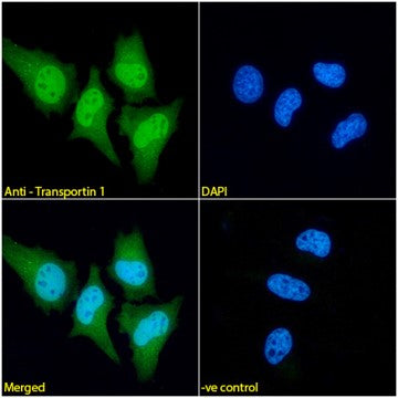 Immunofluorescence analysis of paraformaldehyde fixed HeLa cells,  permeabilized with 0.15% Triton. Primary incubation 1hr (1:100 dilution) followed by Alexa Fluor® 488 secondary antibody (1:1000 dilution), showing nuclear and cytoplasmic staining. The nuclear stain is DAPI (blue). Negative control: Mouse IgG1 negative control followed by Alexa Fluor® 488 secondary antibody.