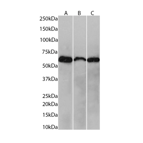 (0.1µg/ml) staining in HepG2(A), (0.3µg/ml) staining in MCF7(B) and (0.1µg/ml) staining in U937(C) cells lysate (35µg protein in RIPA buffer). Primary incubation was 1 hour. Detected by chemiluminescence.