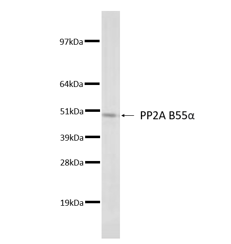 HeLa lysate run on 4-12% Bis-Tris 2D gel in 1 x MOPS running buffer. Transfer to 0.45µm nitrocellulose. Membrane probed with 2G9 (anti-PP2A-B55α). Anti-mouse IgG (whole molecule)-AP conjugate (1 in 2,000). Detection with BCIP/NBT substrate
