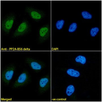 Immunofluorescence analysis of paraformaldehyde fixed HeLa cells,  permeabilized with 0.15% Triton. Primary incubation 1hr (1:100 dilution) followed by Alexa Fluor® 488 secondary antibody (1:1000 dilution), showing nuclear staining. The nuclear stain is DAPI (blue). Negative control: Mouse IgG1 negative control followed by Alexa Fluor® 488 secondary antibody.