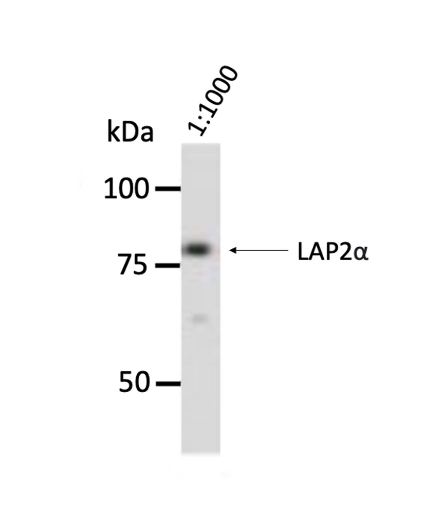 Hela cells were boiled in Laemmli buffer and the proteins were separated by 8% SDS-PAGE and blotted onto nitrocellulose membrane. The membrane was blocked in 3% NFDM in PBS-T for 1h at RT and incubated at 4°C o/n with anti LAP2α, clone 3A3 antibody at the indicated dilution in 0.5% NFDM/PBS-T. After incubation with anti-mouse Fc-HRP coupled secondary antibody for 1h at RT, ECL was performed with the Western Lightning reagents. A 30sec exposure is shown.