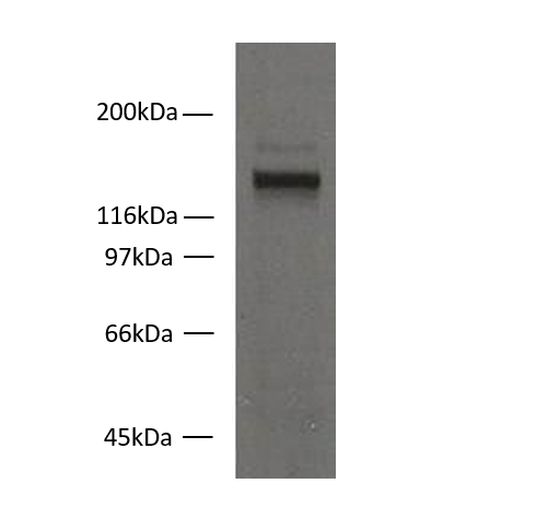 Western blot - Anti-Desmoglein 2/DSG2 (10D2) on HaCat keratinocyte cells
