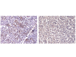 Staining of human pituitary gland with clone A9E4 at 1/200 dilution.  Left-hand image shows weak positive staining of pituitary gland cells.  Right hand image show negative control of same tissue