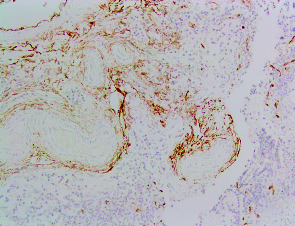Immunohistology staining with IQ708R-1 CD34 [ICO1154C11], Rabbit IgG, Kappa, Recombinant Monoclonal Antibody.    Antibody at 1/100 dilution staining formalin-fixed paraffin embedded human lymph node, showing staining of endothelial cells.   Antigen retrieval was performed using citrate buffer at pH 6 for 20 mins. 