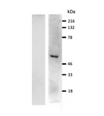 GLP1R Antibody [IQGLP1R Polyclonal]: WB