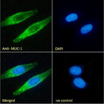 Immunofluorescence analysis of paraformaldehyde fixed MCF7 cells. Primary incubation 1hr (1:100 dilution) followed by Alexa Fluor® 488 secondary antibody (1:1000 dilution), showing membrane staining. The nuclear stain is DAPI (blue). Negative control: Mouse IgG1 negative control followed by Alexa Fluor® 488 secondary antibody.