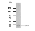 WB -Emerin Monoclonal Antibody [MANEM1(5D10)] on Human fibroblast extract