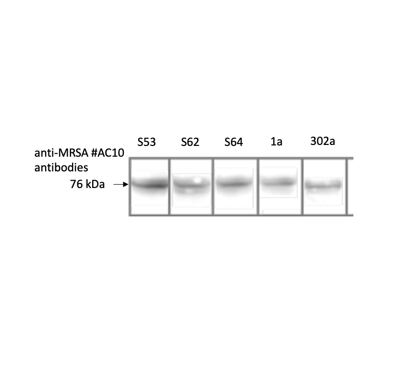 Western blot using antibody IQ377 (clone AC10) on 5 different MRSA strains.    Staph. Aureus cells were boiled for 5 minutes, and then loaded onto 12% SDS-PAGE gels.  Following SDS=-PAGE separation, proteins were blotted on to nitrocellulose membrane, before being incubated with antibody at 1/1,000 overnight.  Bound antibody was detected with HRP-conjugated anti-mouse IgG. Clone AC10 binds to a protein of 76kD, consistent with the expected size of PBP2a.