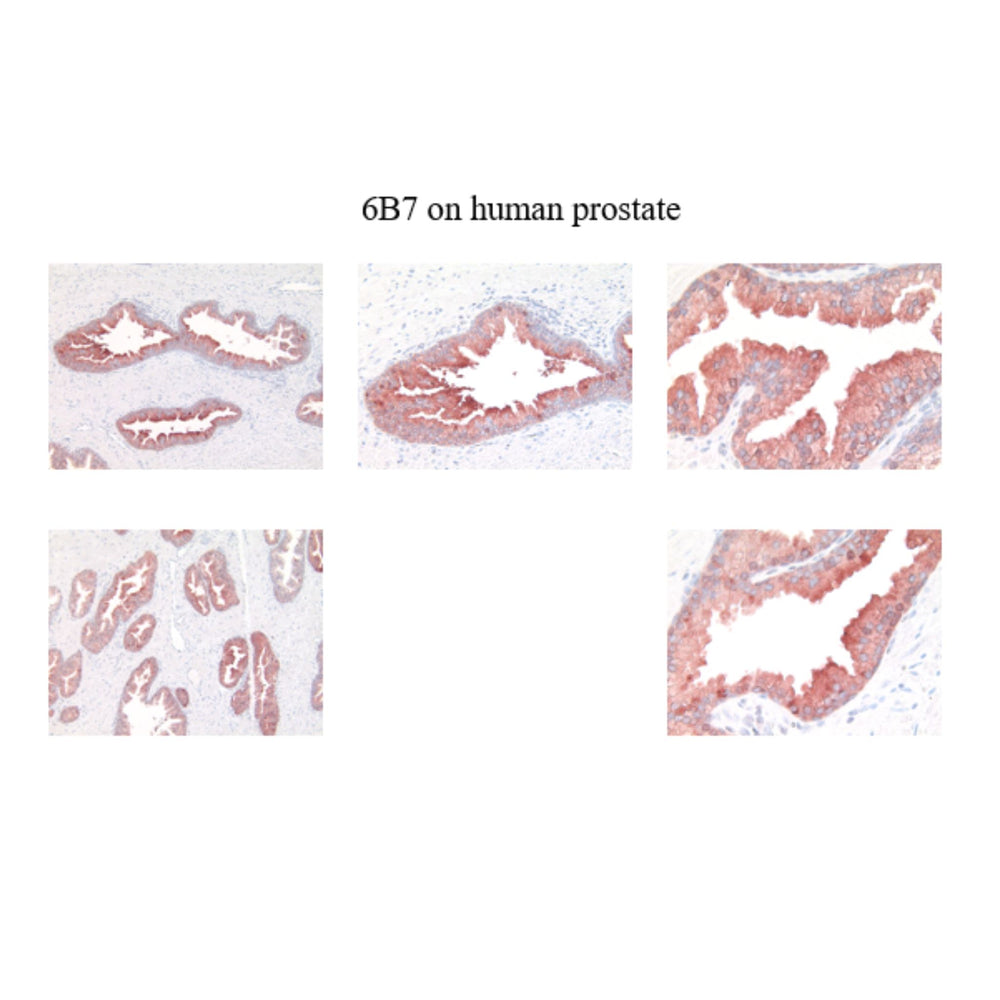 Immunohistochemistry - Anti  Kallikrein 2 Antibody [6B7] on human prostate