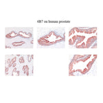 Immunohistochemistry - Anti  Kallikrein 2 Antibody [6B7] on human prostate