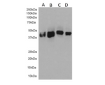 Western Blot of clone C-11 anti-pan cytokeratin (0.001µg/ml) with cell lysates of MCF7 (A), A549 (B), HeLa (C) and 293 (D) (35µg protein). Expected MW in range of 40-68kD. Observed MW in these cell lines of 40-50kD. Primary incubation was 1 hour. Detected by chemiluminescence.