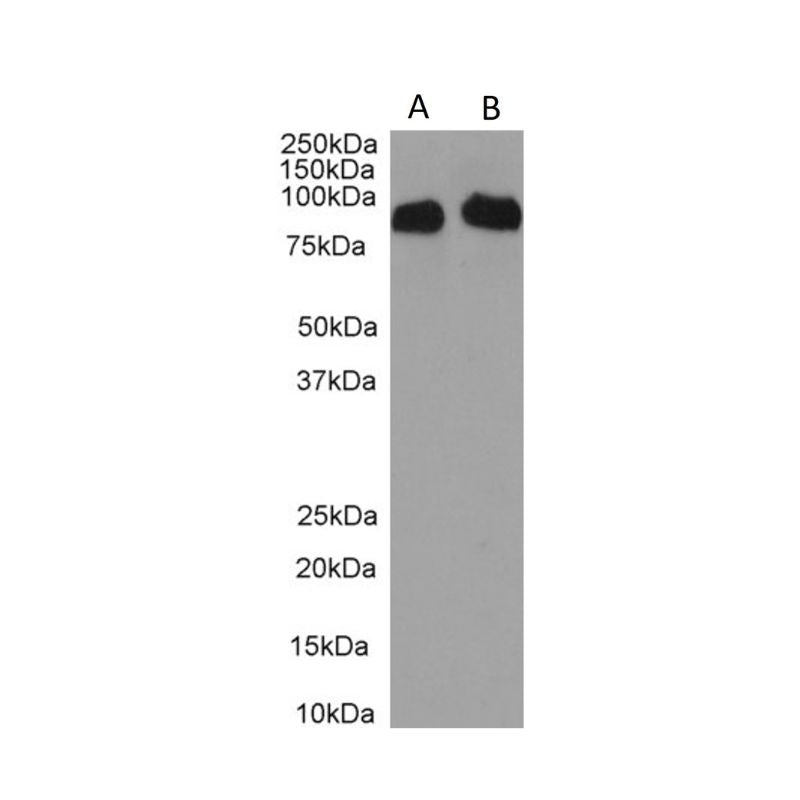 Western Blot of clone ICO1154C11 anti-human/rat CD34 (0.3µg/ml) with cell lysates of human placenta (A) and uterus (B) (35µg protein). Expected MW 41kD, observed 95-100kD due to PTM. Primary incubation was 1 hour. Detected by chemiluminescence.