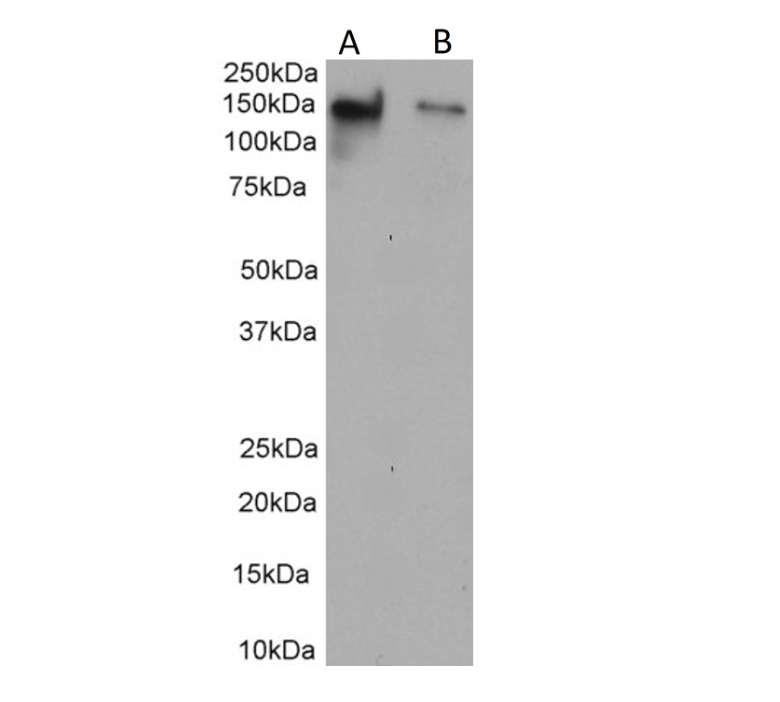 Western Blot of clone VU-3D1 anti-human MUC-1 (1µg/ml) with cell lysates MCF7 (A) and HeLa (B) (35µg protein). Expected MW 122kD, observed 150kD. Primary incubation was 1 hour. Detected by chemiluminescence.