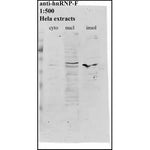 Western blot using hnRNP F Antibody (IQ207) and Hela extracts