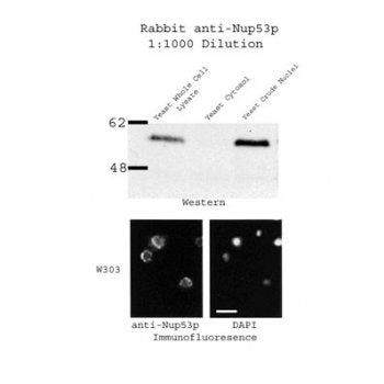 Western blot using Nup53p Antibody (IQ240) and yeast extracts