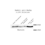 Western blot using Mad2p Antibody (IQ243) and yeast extracts