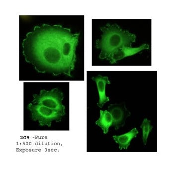  Immunofluorescence - Anti-HEF1 Antibody [2G9]