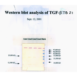 TGF beta1 Monoclonal Antibody [TB21]