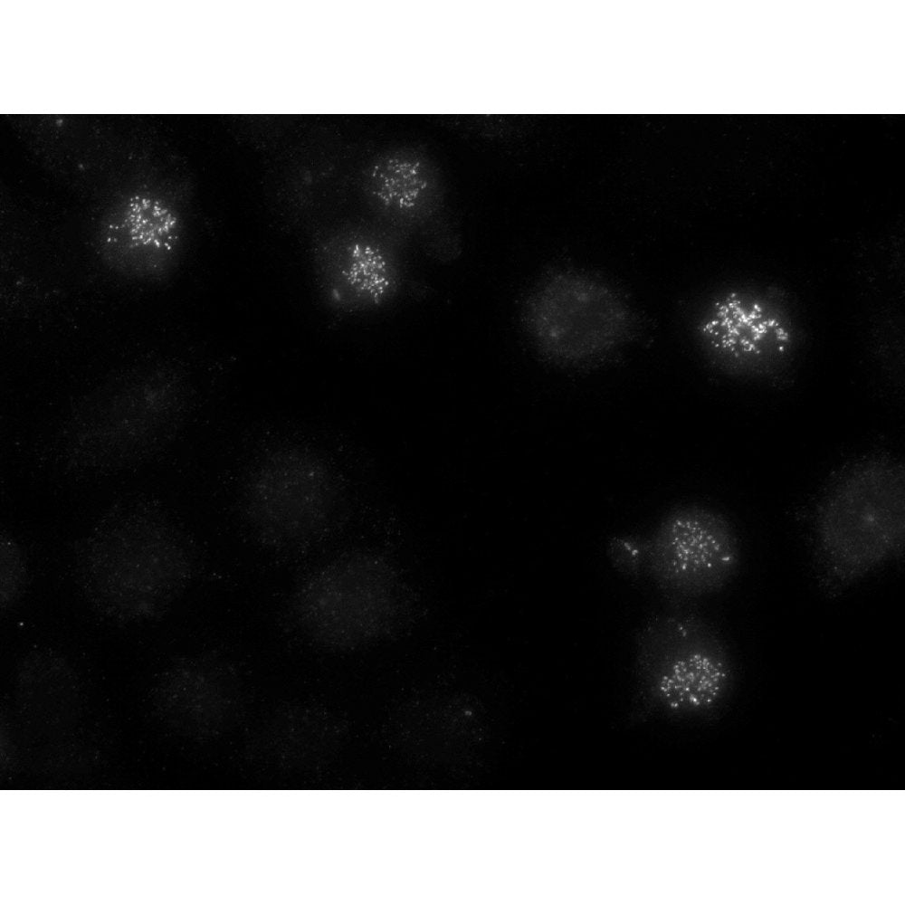 Immunofluorescence -  Anti-CENPE Antibody (1H12) on Ovarian cancer cells