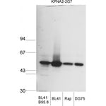 Western blot using KPNA2 Antibody (IQ305)