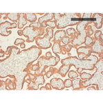 Immunohistochemistry - Anti  Cytokeratin AE1 Antibody [CK 210 (AE1)] on placenta