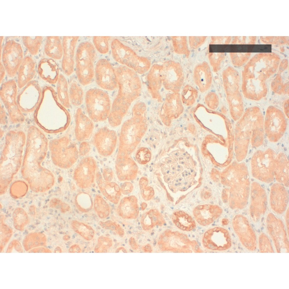 IHC using Cytokeratin [CK 211 (AE3)] antibody (IQ289) on Human kidney
