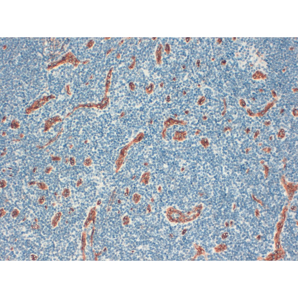 Immunohistochemistry FFPE - Anti CD34 [QBEND/10]  on Human Lymph node