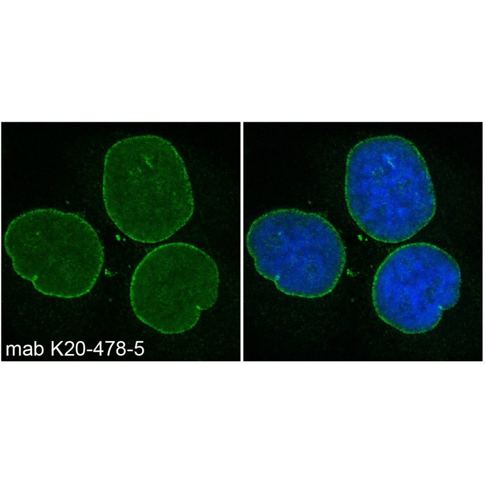 IF  using Nesprin 2 Monoclonal Antibody IQ562 [K20-478-5] (1:500)  HaCaT cells were fixed in 3% paraformaldehyde for 15 min and permeabilized with 0.5% Triton X-100 in PBS for 5 minutes. As secondary antibody goat anti mouse Alexa 488 was used. DNA was stained with DAPI.