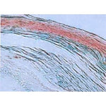 IHC using Hair Cortex Cytokeratin [AE13] Antibody (IQ292)