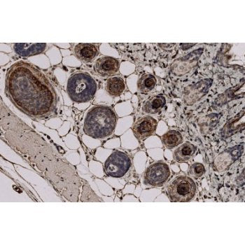 Immunohistochemistry - Anti Trichohyalin antibody [AE15] staining Trichohyalin in Mouse skin tissue sections