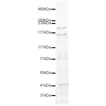 Immunoblot - Trichohyalin Antibody [AE15] 