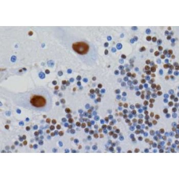 hnRNP U/p120 Monoclonal Antibody [3G6]: IHC