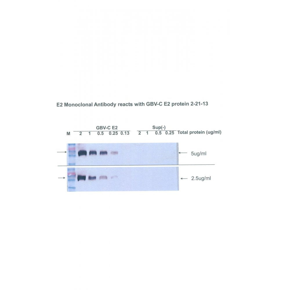 Western blot using mouse anti GBV-C virus E2 glycoprotein specific antibody (clone UIE2-1, IQ584) to detect recombinant GBV-C E2/Fc fusion protein expressed in CHO cells.  Right hand lanes show a CHO cell supernatant negative control