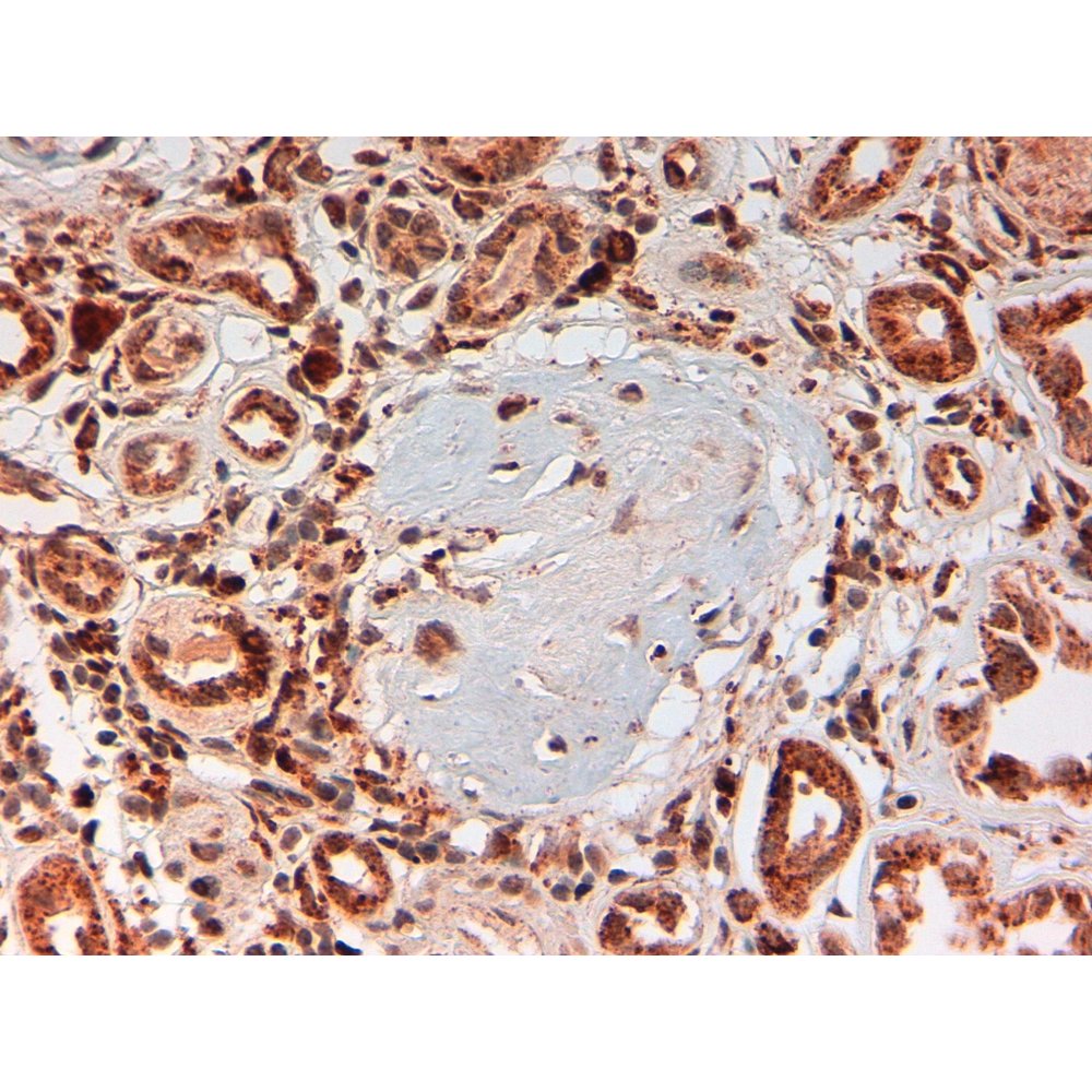 Immunohistochemistry (Formalin/PFA-fixed paraffin-embedded sections) - Anti-Human C4d [LH61] on Human kidney (Lupus E.)