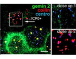 Immunofluorescence using Gemin 2 Antibody (IQ203)