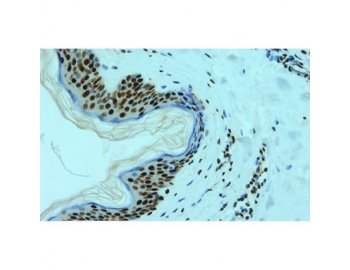 Immunohistochemistry (Formalin/PFA-fixed paraffin-embedded sections) - hnRNP L antibody [4D11] on Human normal skin